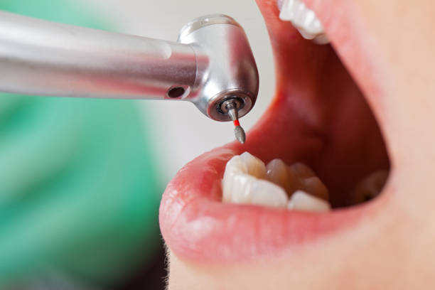 Best Emergency Dental Care for Trauma or Injury in Waller, TX
